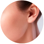 Tratamiento contra el acné con láser Isolaz